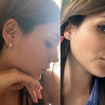 Federica V